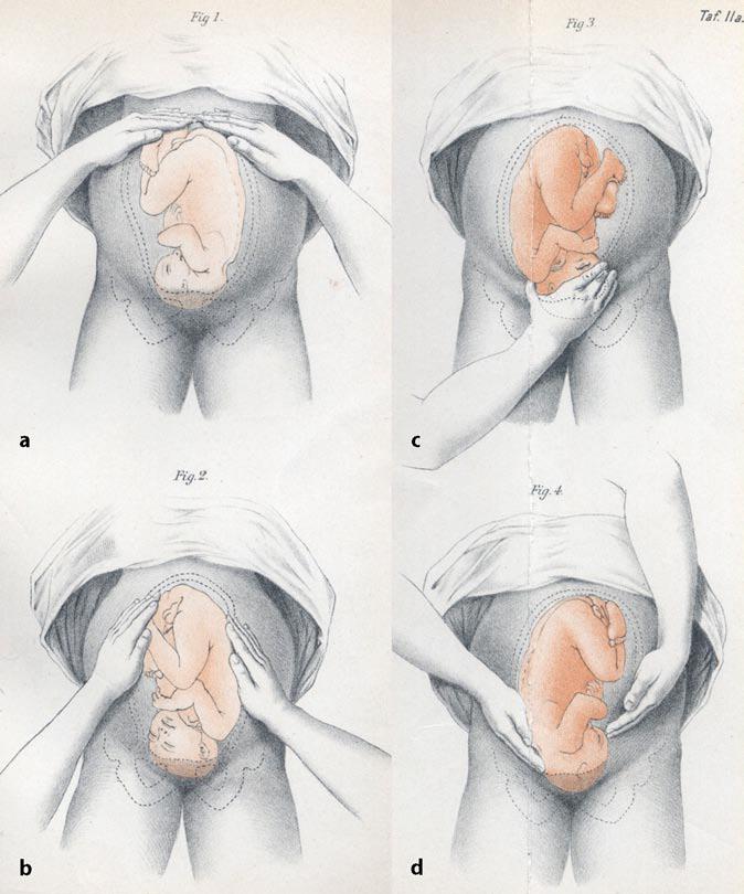 fisioterapia obstetrica